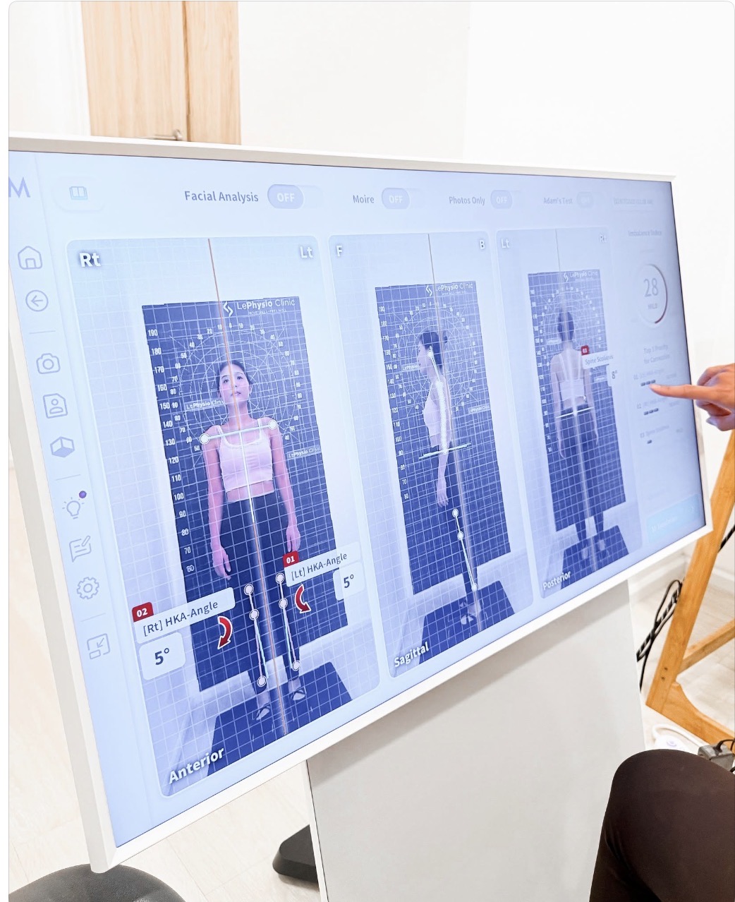 Moti 3D AI Posture Analysis scan screen showing real-time 3D body posture assessment